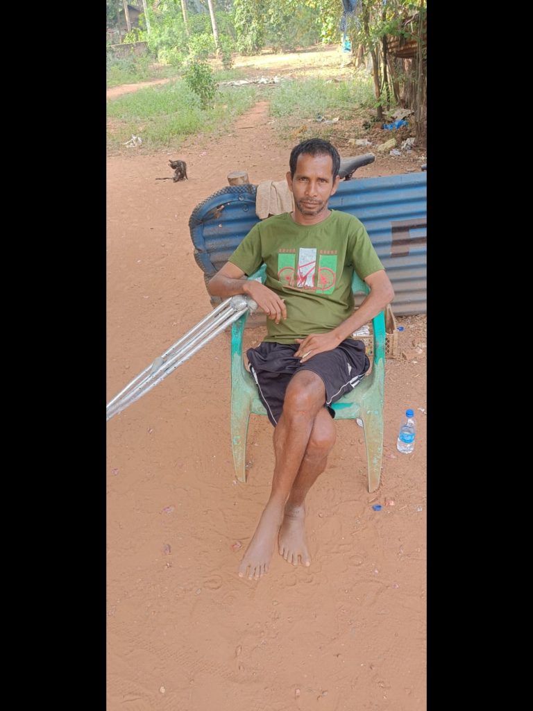 A man in a green t shirt and black shorts, sitting on a plastic chair with crutches on the side